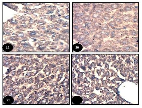 Photomicrograph Of Control Liver Section From Control Showing The Download Scientific Diagram