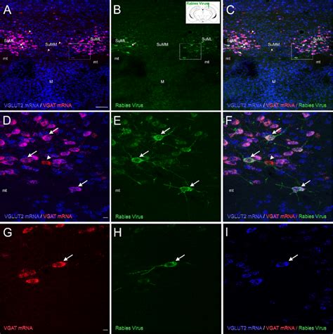 Neurochemical Features Of Suml Neurons Innervating The Dorsal Dentate