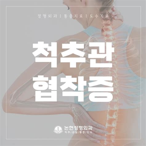 오래걸으면 허리가 아파요 원인은 강남역정형외과 네이버 블로그