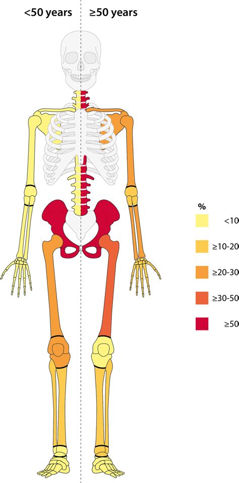 Fracture localisation and prevalence of osteoporosis in patients at or ...