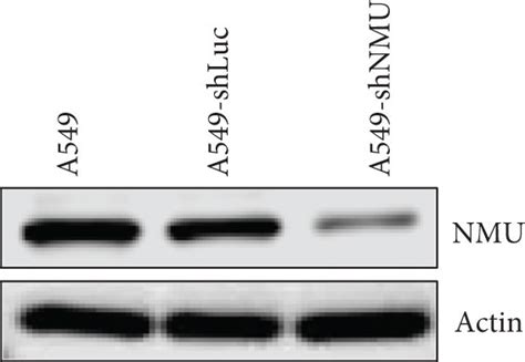 Knockdown Of Nmu Inhibits Luad Cell Proliferation And Clone Formation