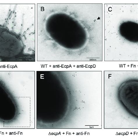 Binding Of Fn To Epec Negative Staining And Immunogold Labeling Of Download Scientific Diagram