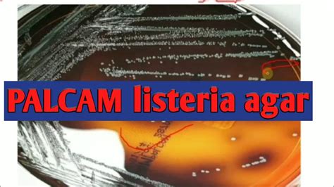 PALCAM Listeria Agar Medium Culture Media Lecture 21st YouTube