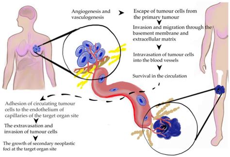 Biomedicines Free Full Text Cooperation Between Angiogenesis