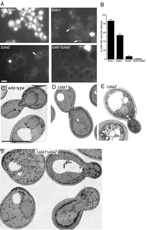 Endocytosis And Membrane Trafficking In ∆sla1∆sla2 Cells A Fluid Download Scientific Diagram