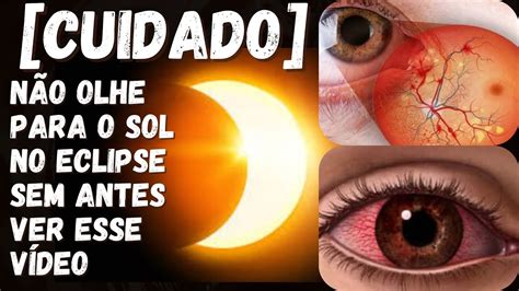 CUIDADO ECLIPSE SOLAR NÃO OLHE SEM ANTES VER ESSE VIDEO EXISTE UM