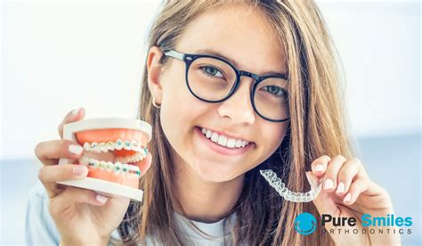 Learn What The Differences Are Between Braces And Clear Aligners