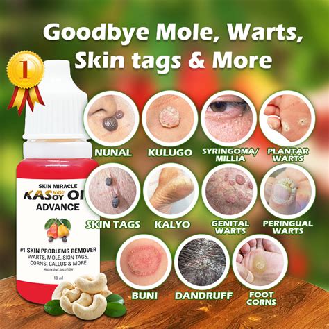 No 1 Skin Problems Remover Mole Warts Skin Tag Effective