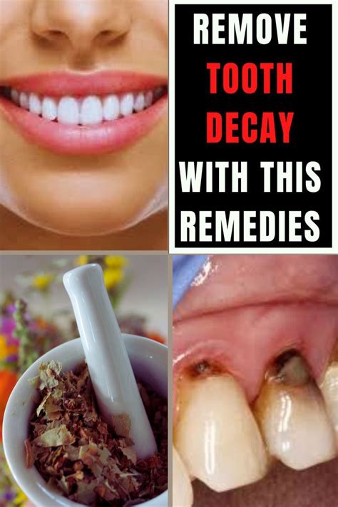 This Simple 20 Second Trick Turns Back Years Of Tooth Decay In 2022