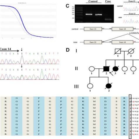 A Novel Splicing Mutation C G A In The Fus Gene Identified In A