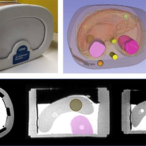 The Cirs Triple Modality Ct Mri And Ultrasound 3d Abdominal Phantom Download Scientific