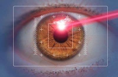 Lasik Lasers Explained Assil Gaur Eye Institute Of Los Angeles