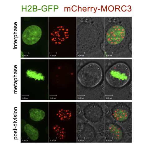 Morc Forms Nuclear Condensates Through Phase Separation Abstract