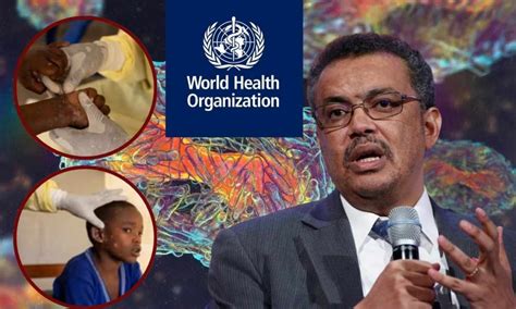 Who Declares A Global Public Health Emergency Following Mpox Outbreak