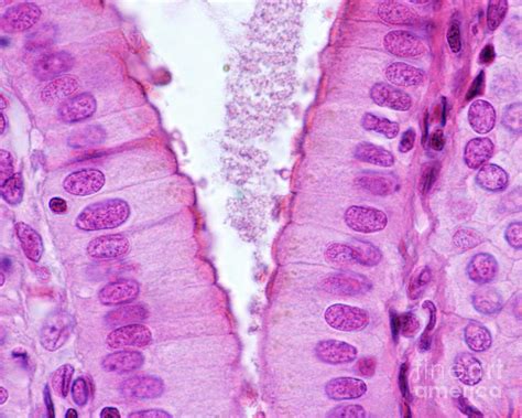 Simple Columnar Epithelium Photograph by Jose Calvo / Science Photo Library | Pixels