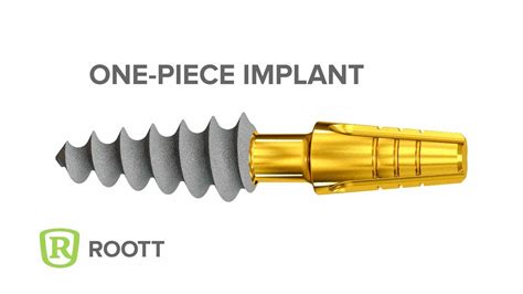 ROOTT C Dental Implants YouTube