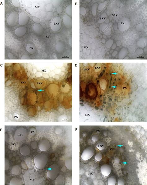 Bright Field Microscopy Root Images Showing High Fungal Colonization In