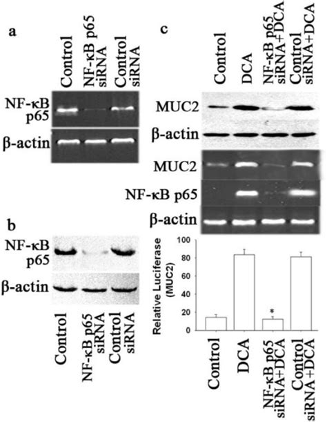 Effects Of Nf κb P65 Sirna On Expression Of Muc2 Seg Open I