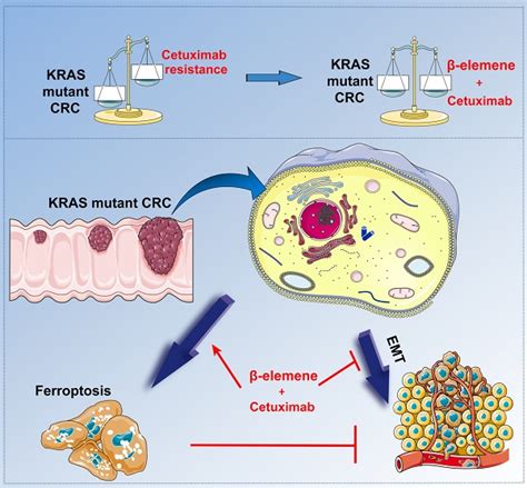 Combinative Treatment Of β Elemene And Cetuximab Is Sensitive To Kras