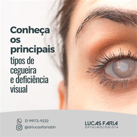 Conheça os principais tipos de cegueira e deficiência visual Lucas