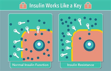 Insulin Helps Control Your Diabetes My Doctor Online