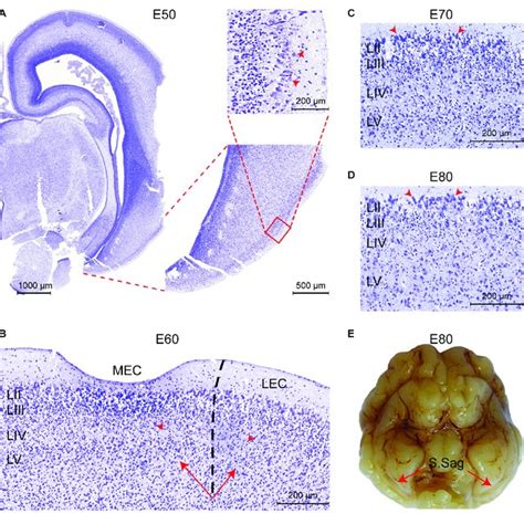 The Entorhinal Cortex Ec Forms Between Embryonic Day E50 And E60