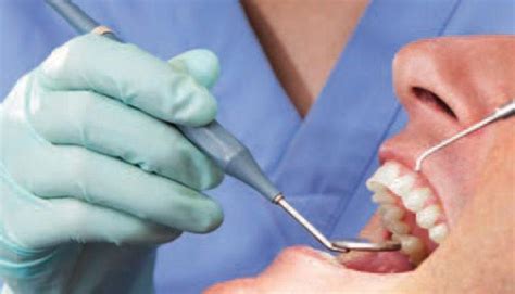 Oral Cancer Detection And Life Saving Measures Canyon Gate Dental Of Orem