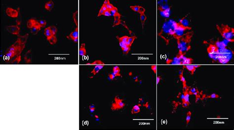 Fluorescent Images Of HCT116 Cells Stained With LipidTOX Treated With