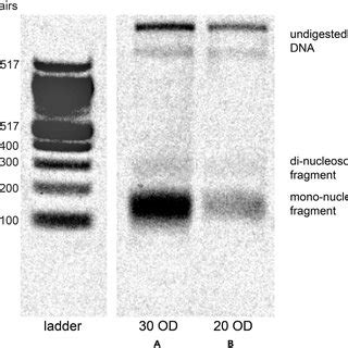 Sample Gel Showing Properly Digested Nucleosome Footprints Agarose Gel