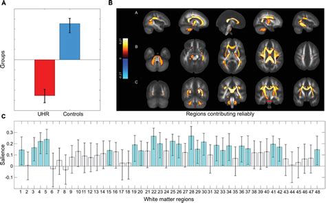 Frontiers White Matter Microstructure And Sleep Wake Disturbances In