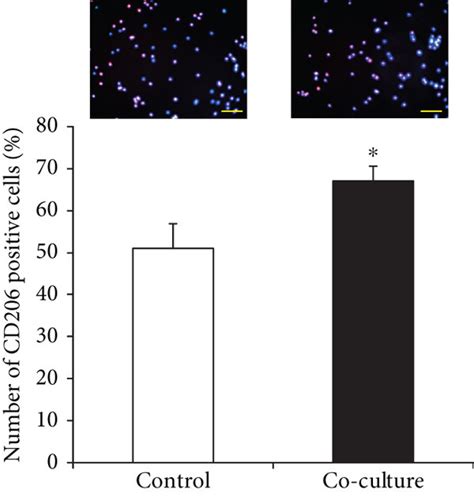 Admscs Induce Macrophage M2 Polarization A Qpcr Analysis Of