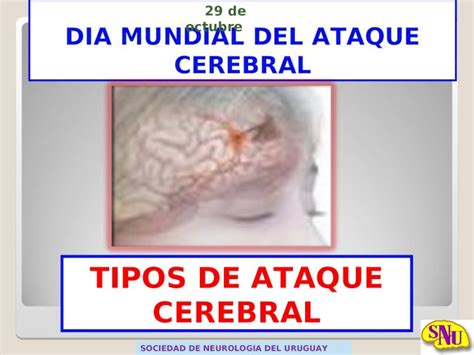 Ppt Dia Mundial Del Ataque Cerebral Sociedad De Neurologia Del