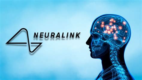 La FDA Aprueba El Implante Del Chip De Neuralink En Un Segundo Paciente