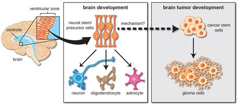 Cancer Neuroscience | Gutmann Research Laboratory | Washington ...