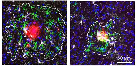 Sans Plexin B Glial Net Tightens Around Plaques Alzforum