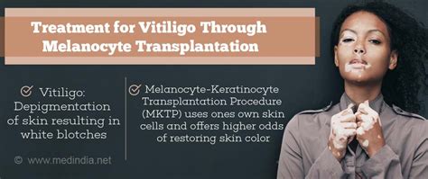 Melanocyte Transplantation Restores Original Skin Color In Vitiligo Patients