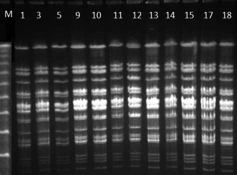 Electrophoretic Patterns By Restriction Fragment Length Polymorphism