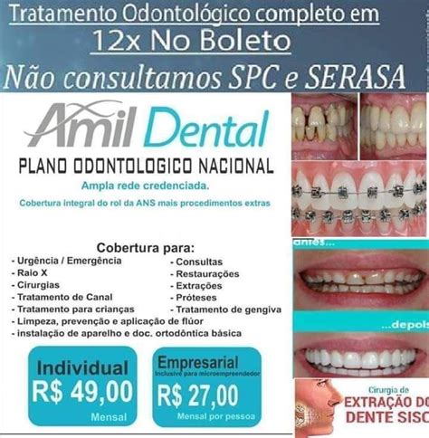 Plano odontológico Amil