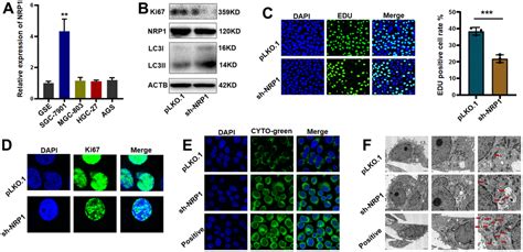 Nrp Regulates Autophagy And Proliferation Of Gastric Cancer Through