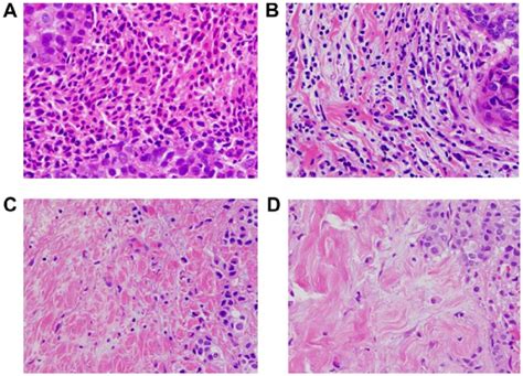 Histopathological TIL Evaluation TILs Were Measured By Examining The