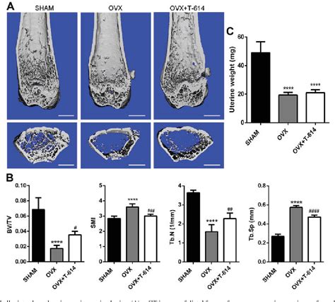 Figure 1 From Iguratimod Prevents Ovariectomy Induced Bone Loss And