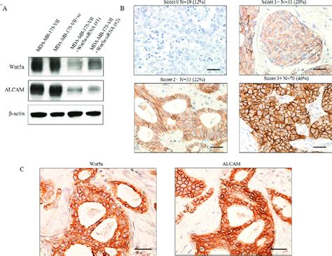 Co Expression Of Wnt5a And Alcam In Er Positive Breast Cancer Tissue Download Scientific