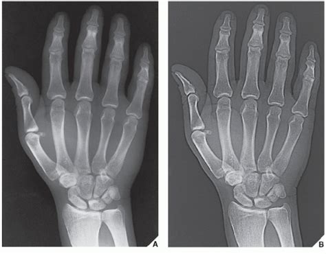 Imaging Techniques In Orthopedics Radiology Key