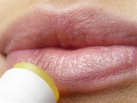 Conoces Los Diferentes Tipos De Labio Consulta Del Dr Colomer