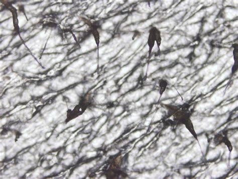 Microscopic examination revealed more than five mites per cm² (original ...