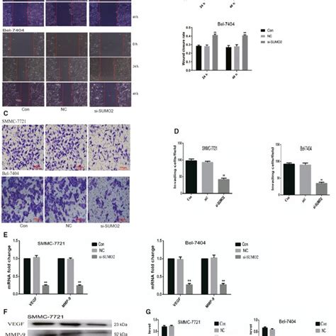 The Downregulation Of Sumo2 Inhibits Liver Cancer Cell Migration And