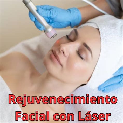 Rejuvenecimiento Facial con Láser Co2 y o Laser IPL Luz PUlsada Intensa