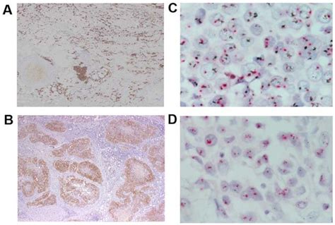 Immunohistochemical Ihc Analysis And Determination Of Her Gene