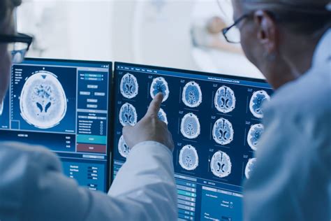 Meningioma síntomas y causas Mejor con Salud