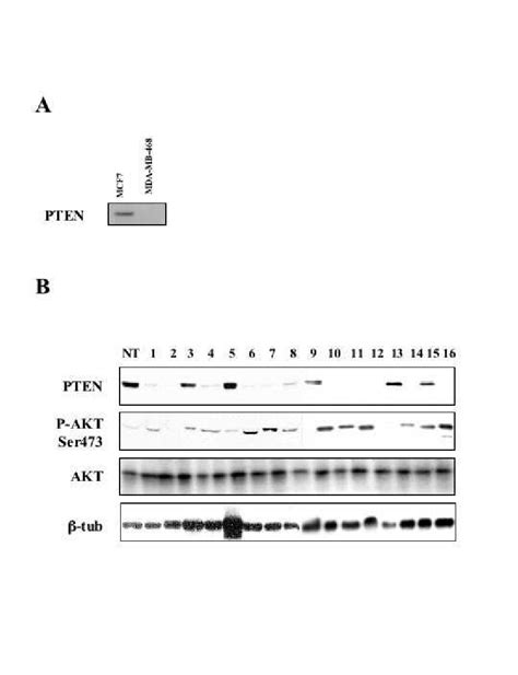 Western Blot Analysis Of Pten Expression In Normal And Neoplastic